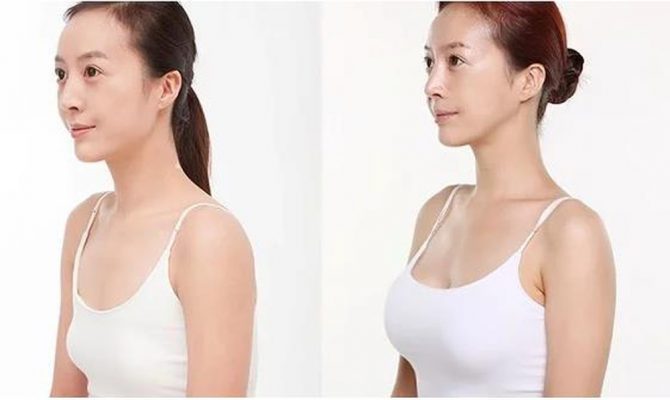 cách làm ngực to tự nhiên tại nhà